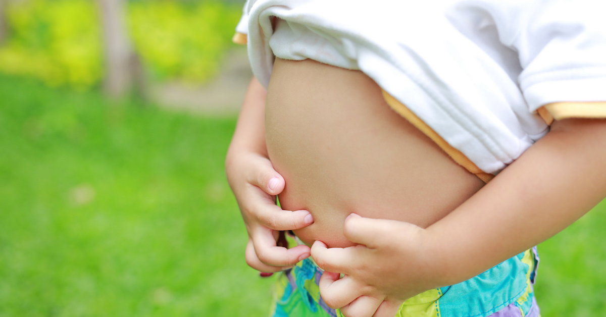 How does histamine intolerance manifest in children?